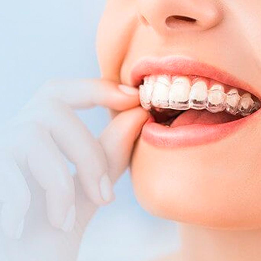 Maple, Ontario Invisalign provider